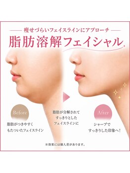 クラージュの写真/【たるみ改善×小顔】結果重視の医療提携サロンでたるみにアプローチ◎脂肪分解液導入＋美顔フェイシャル
