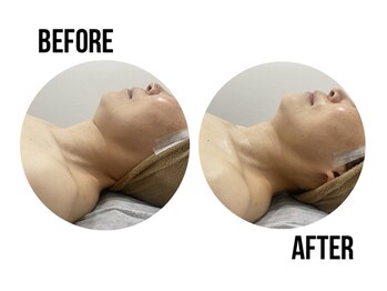 イードット(E.)/幅広い年代の方に人気エステ♪