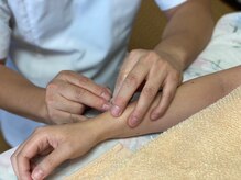 浅間口はりきゅう院/手のしびれに