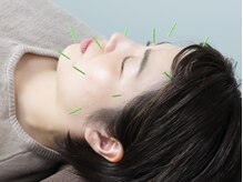 坂田鍼灸治療院/美容鍼水素吸入【板橋/新板橋】