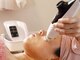 ドール(doll)の写真/乳酸ピーリングで肌のターンオーバーを正常化☆肌に優しいので肌が敏感な方にも◎お化粧ノリもUPで嬉しい♪