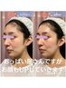 【お顔のもたつきをUP☆素肌美へ♪】バストUP技術活かしお顔UP↑¥9900→¥7700