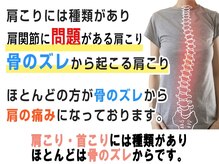 こう整骨院/肩こりには種類があります