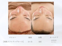 ベレガ 大阪本店(BELEGA)/◆ビフォーアフター◆