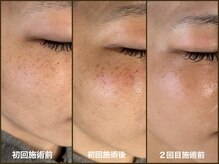 リプラス(RE.PLUS)の雰囲気（諦めてた肌悩みに本気で向き合い、二輪三脚で改善を目指します！）
