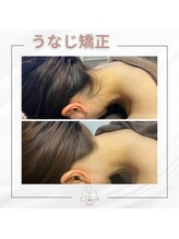 ミース 宮崎店/『宮崎初！うなじ矯正』