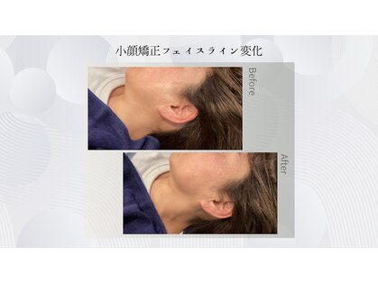 プルベル 宇都宮店(Plus Belle)の写真
