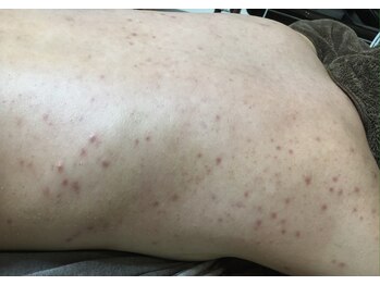 ココティー 金沢駅前店(Cocotii)/グリーンピールボディ 