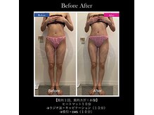 フェイス(TwinQle)の雰囲気(理想のボディー「スラっと美人」)