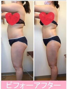 ルピナージュ(Lupinage)/ビフォーアフター