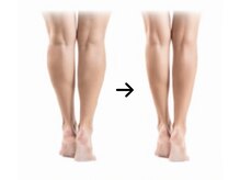 エイジェイビューティー 上野店(AJ Beauty)/美脚痩身施術