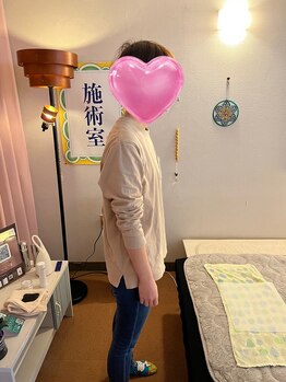 整体アトリエ ドープ(DOPE)/猫背で悩むお客様も多数ご来店。