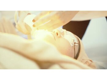 ドリームローズ(Dream Rose)/顔美肌脱毛