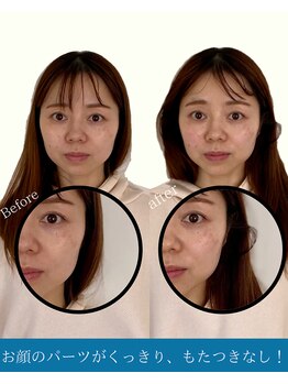 ハリラボ(hari Lab.)/【お客様の声】