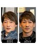 【メンズ人気No.1】独自メソッド特許肌施術×日本で6人のみの整形級小顔術