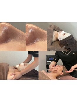 毛穴ケアをしたい