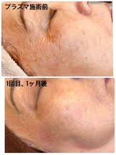 アースコアフュールボーテ ひたち野うしく店(EARTH coiffure beaute)/プラズマシャワー