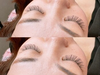 アイ ビューティー インクリース 岸和田店(Eye beauty increase)の写真/【遂に日本上陸☆韓国で大人気】第5世代韓国プラピーリング導入店![美白ケア/高保湿/韓国フェイシャル]
