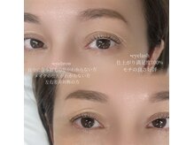 ビアンカ(Bianca)