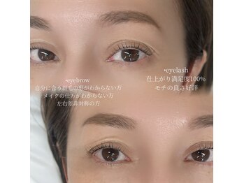 ビアンカ(Bianca)