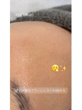 アート 熊本並木坂店(ART)/CSP/美白フラッシュコース/60分