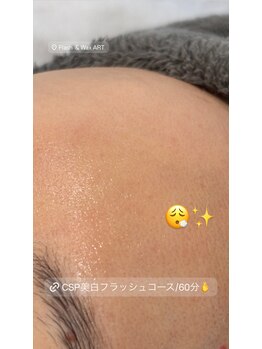 アート 熊本並木坂店(ART)/CSP/美白フラッシュコース/60分
