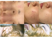 クレドペール(Eclat de Perles)