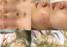 クレドペール(Eclat de Perles)