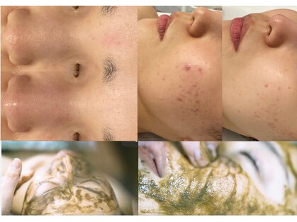 クレドペール(Eclat de Perles)の写真