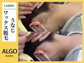 アルゴ 小倉守恒店(ALGO)/うなじワックス脱毛