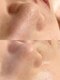 リンダ 西宮店(LINDA)の写真/毛穴悩みに終止符！毛穴洗浄&肌質改善ハーブピーリングで目指す、憧れの陶器肌へ☆