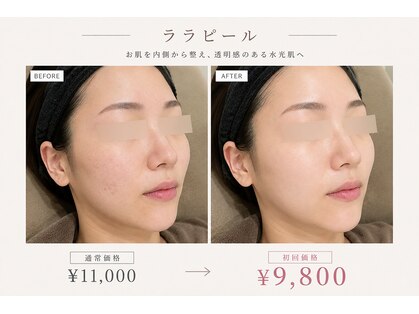 リレイスフクオカ(RelaceFUKUOKA)の写真