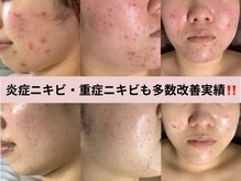 プレジール(plasir)