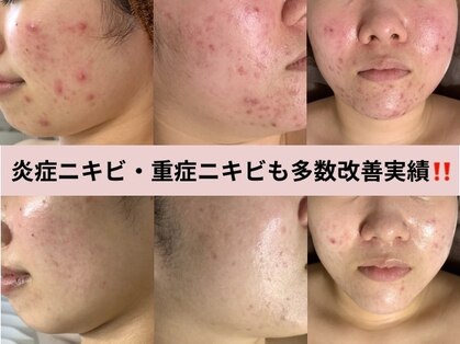 プレジール(plasir)の写真