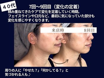 ジュジュ(juju)の写真/【あなたの“本来の美しさ”を一緒に育てる、あなたに合うケアを考えていく伴走型の看護師在籍サロン】