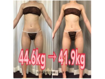 ボディエステティック アクアオーラ 富山店/細い方でもこんなに変わります！