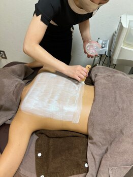 剃らないとソン 金山店/背中専用の酵素パックです