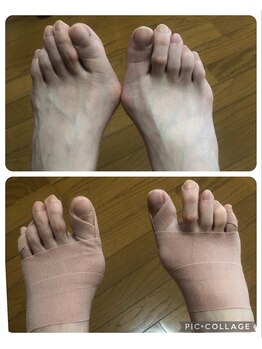 足楽ほんぽ/足の骨格矯正