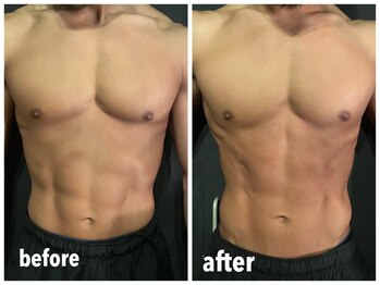 エイティスト(EiGHTiEST)/メンズ痩身