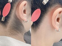 ネリネ 天神(nerine)/大人気うなじWax☆部分脱毛