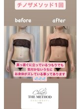 アジャストメント ナチュラル(adjustment natural)/Before&After