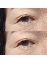 エルモ(elmo)/瞼にも負けないパーマ