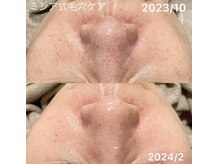 ルココン エミュ(le cocon e'mue)/ミシア式毛穴ケア