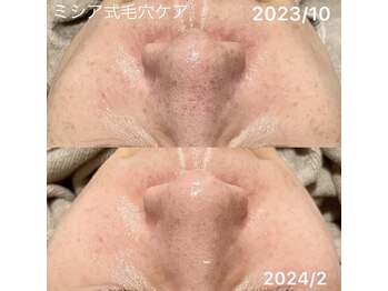 ルココン エミュ(le cocon e'mue)/ミシア式毛穴ケア