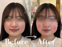 R-1ビューティーサロン 表参道/Before＆After