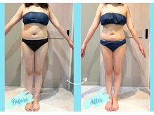 千歳の女神 岡崎店/【施術風景】Before/After