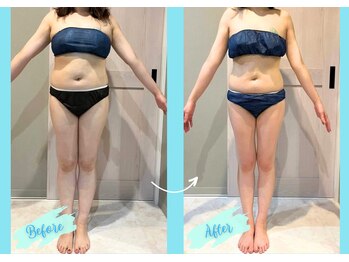 千歳の女神 岡崎店/【施術風景】Before/After