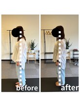 熊本カワル整体 JR上熊本駅院/腹横筋