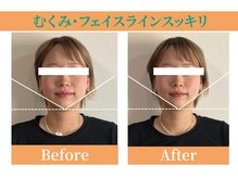 シーワイビー(C.Y.B)/むくみ・フェイスラインスッキリ