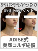 アディス 心斎橋(ADISE)/ADISE式コルギで艶小顔が叶う！